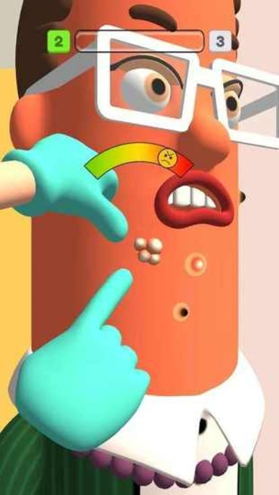 我爱挤痘痘游戏有几关攻略